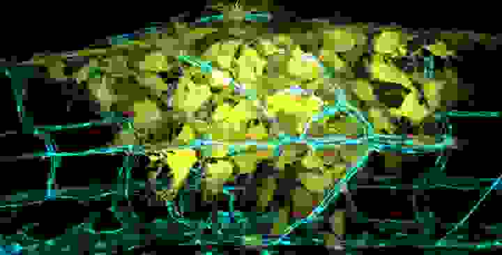 cancer-research