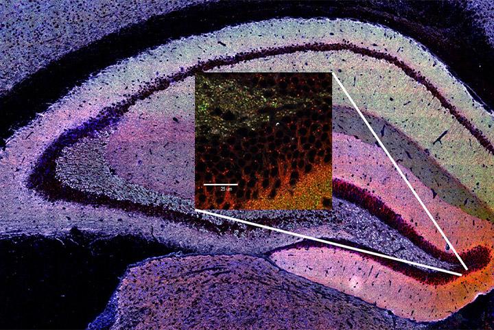 transcriptomics-and-proteomics