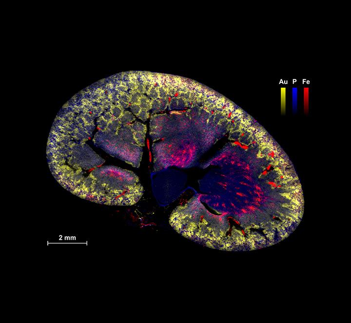 Elemental images obtained by laser-induced breakdown spectroscopy showing the bio-distribution of Iron (Fe), Phosphorous (P) and Gold (Au) in a murine kidney