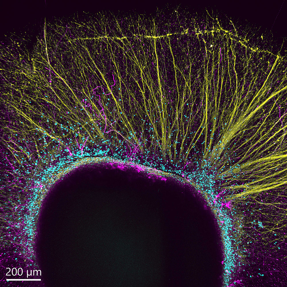 BC43 Image of Mouse embryonic stem cell derived dopaminergic neurons cultured on top of a collagen hydrogel, expressing tyrosine hydroxylase and GAP43.