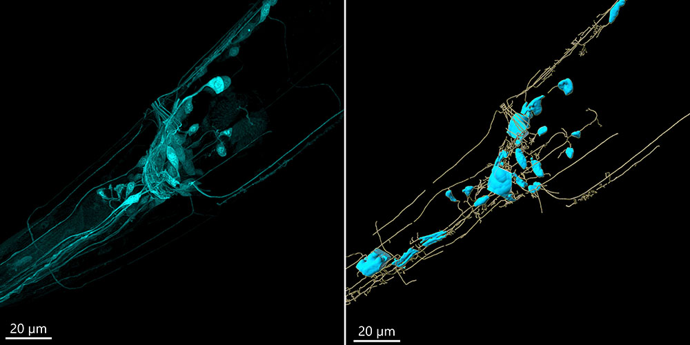 C.elegans neurons imaged with BC43.