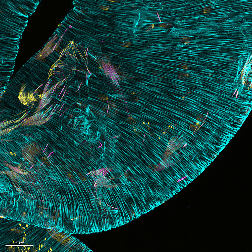 Drosophila testis showing different stages of sperm individualization