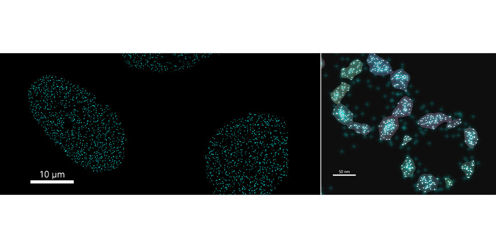 Nuclear pores imaged with Dragonfly.