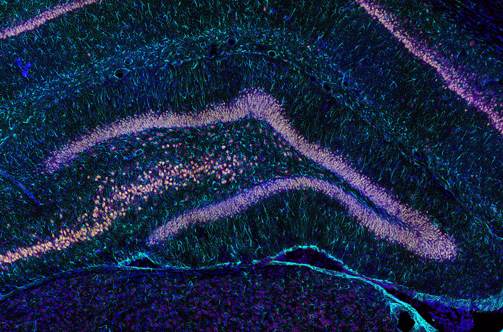 Rat hippocampus section stained for marker of oxidative stress.