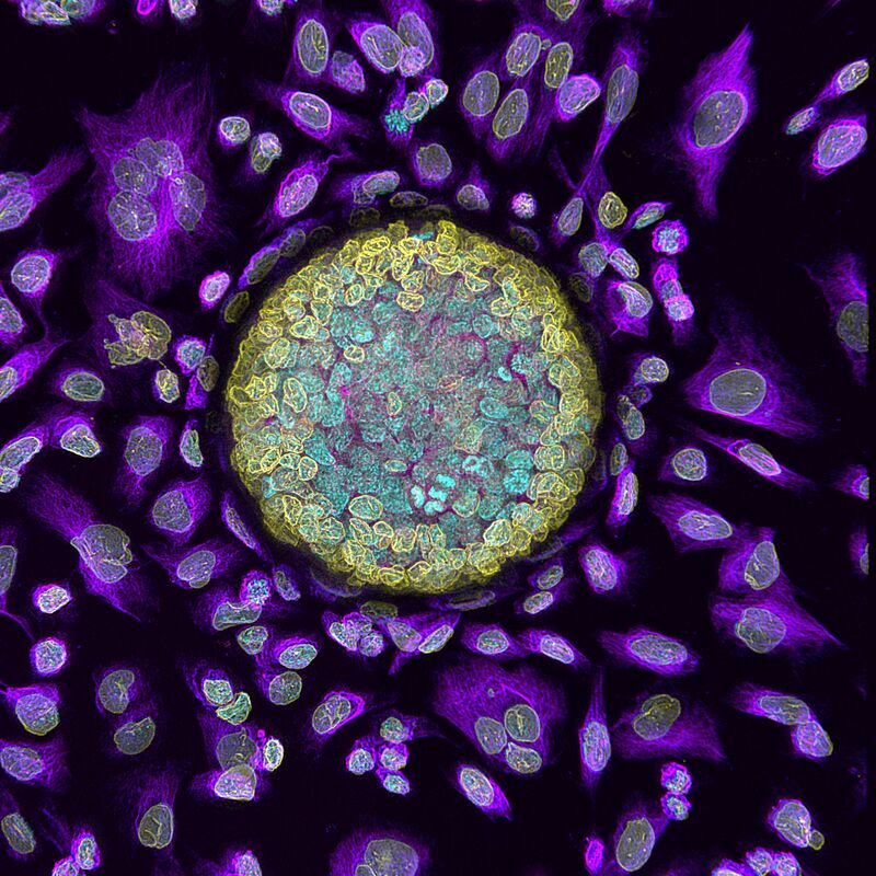 Organoid